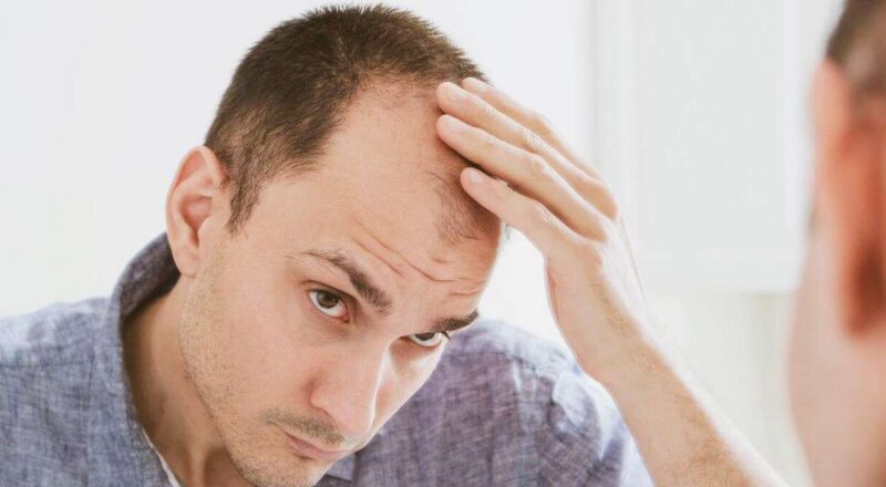 Frasco de minoxidil com cabelo crescendo ao fundo